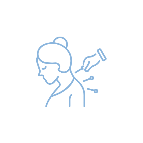 Akupunktura Gryfino — leczenie bólu i napięcia mięśniowego