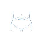 fizjoterapeuta gryfino leczenie blizn