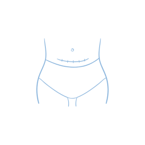 leczenie blizn gryfino aleksandra orlowska