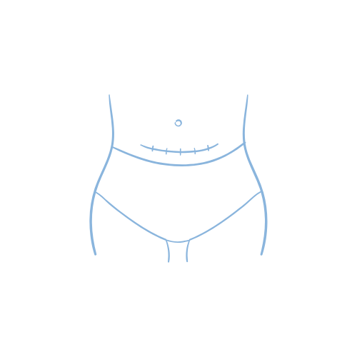 Terapia blizn pooperacyjnych Gryfino — fizjoterapia blizn po cesarskim cięciu